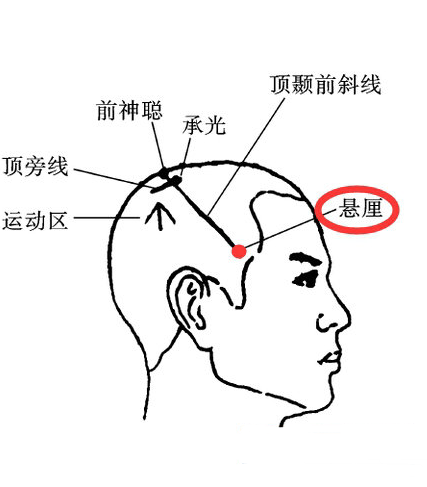圣透灸-6悬厘穴