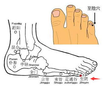 所属经络:足太阳膀胱经 特定穴:井穴 定位: 在足小趾末节外侧,距趾甲