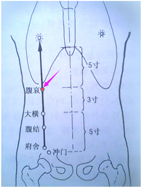 圣透灸-16腹哀穴