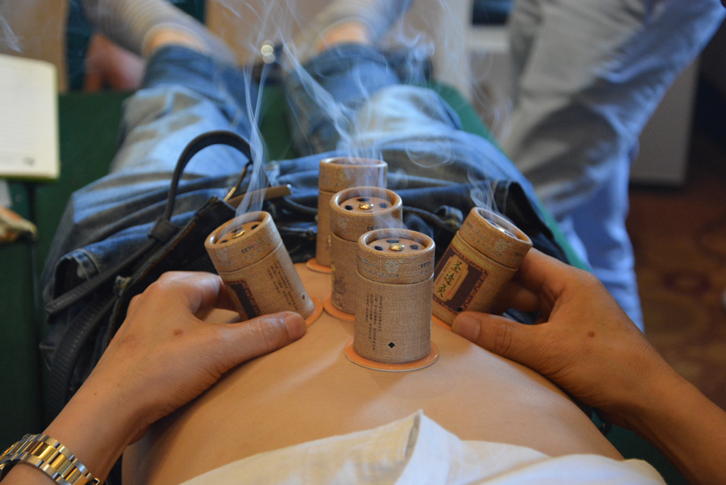 错过了三伏灸可别再错过三九灸